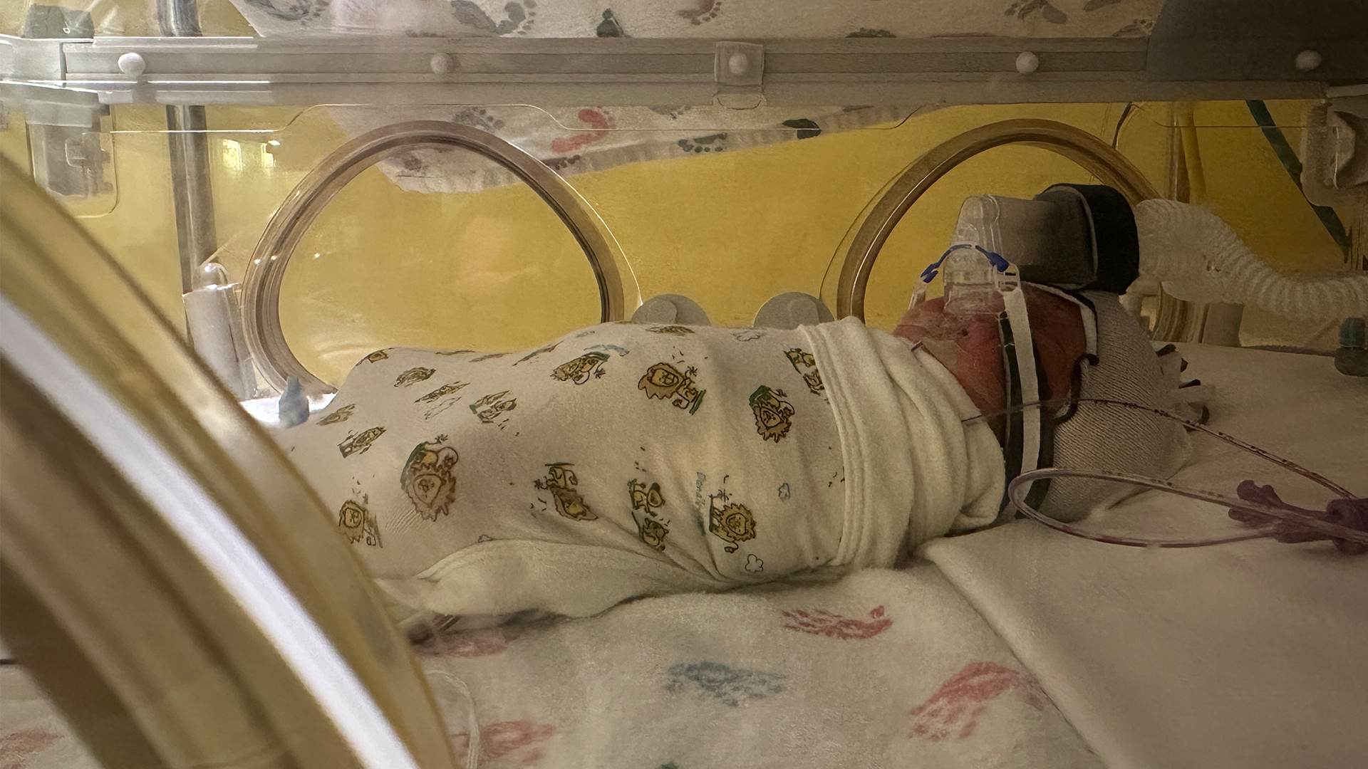 A swaddled newborn resting in a NICU isolette